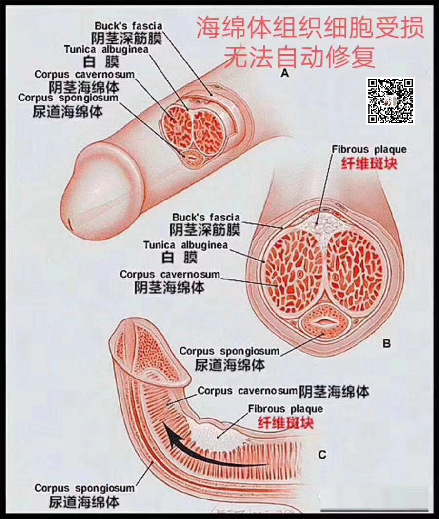 科普：丁丁何时不会再长大，阴茎发育的那些事儿！